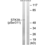 Western Blot - Anti-STK39 (phospho Ser311) Antibody (A8188) - Antibodies.com
