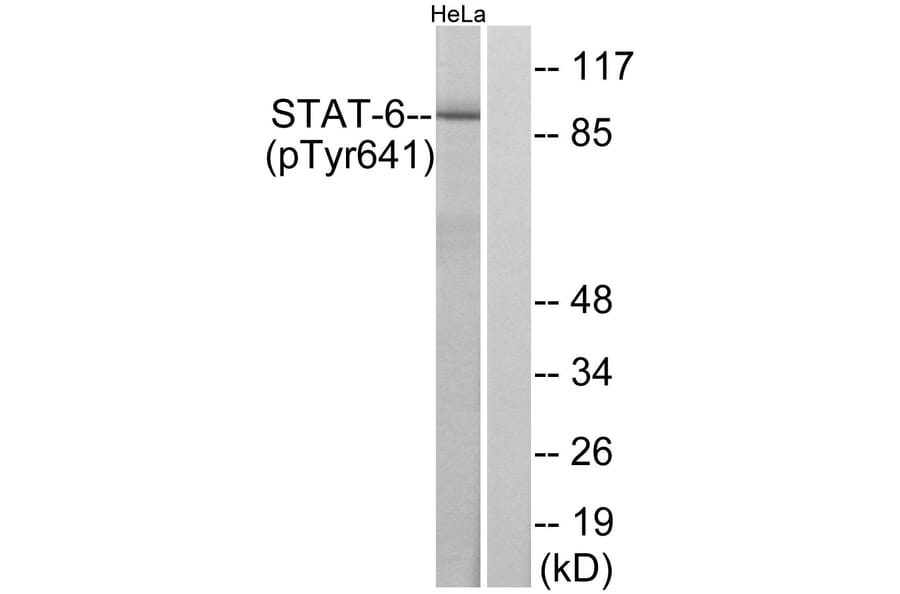Western Blot - Anti-STAT6 (phospho Tyr641) Antibody (A7229) - Antibodies.com