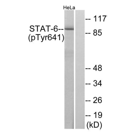 Western Blot - Anti-STAT6 (phospho Tyr641) Antibody (A7229) - Antibodies.com