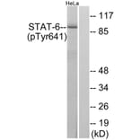 Western Blot - Anti-STAT6 (phospho Tyr641) Antibody (A7229) - Antibodies.com