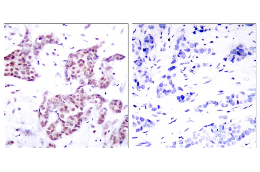 Immunohistochemistry - Anti-STAT6 (phospho Tyr641) Antibody (A7229) - Antibodies.com