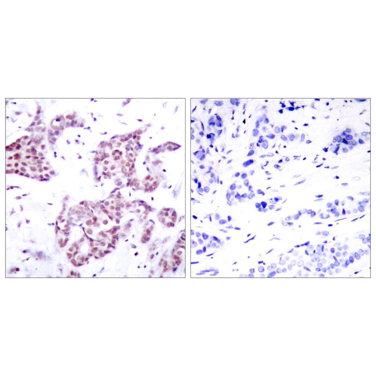 Immunohistochemistry - Anti-STAT6 (phospho Tyr641) Antibody (A7229) - Antibodies.com