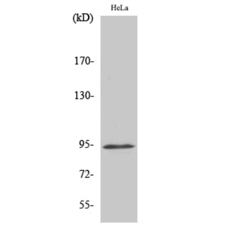 Western Blot - Anti-STAT6 (phospho Tyr641) Antibody (A7229) - Antibodies.com