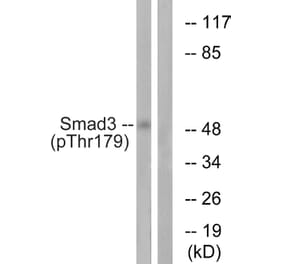 Western Blot - Anti-Smad3 (phospho Thr179) Antibody (A1003) - Antibodies.com