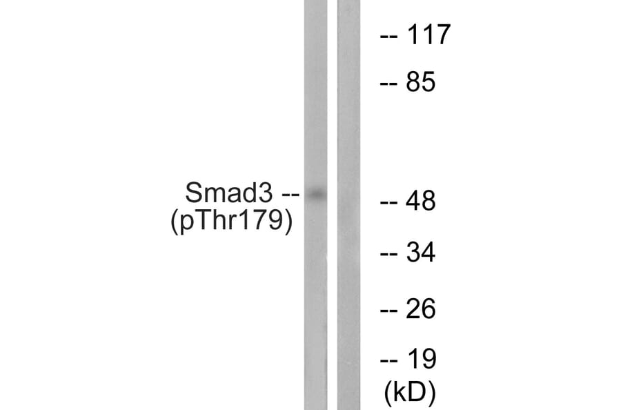 Western Blot - Anti-Smad3 (phospho Thr179) Antibody (A1003) - Antibodies.com