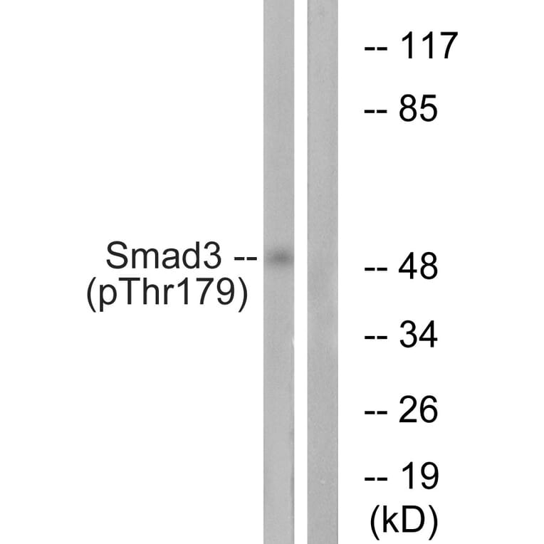 Western Blot - Anti-Smad3 (phospho Thr179) Antibody (A1003) - Antibodies.com