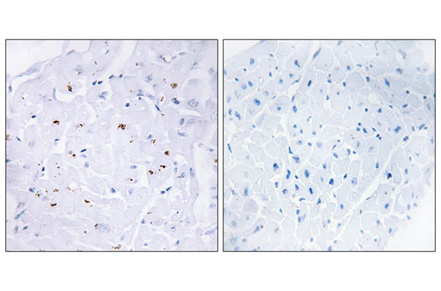 Immunohistochemistry - Anti-Smad3 (phospho Thr179) Antibody (A1003) - Antibodies.com