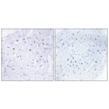 Immunohistochemistry - Anti-Smad3 (phospho Thr179) Antibody (A1003) - Antibodies.com