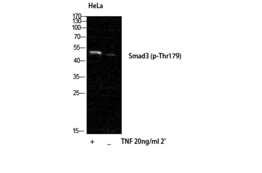 Western Blot - Anti-Smad3 (phospho Thr179) Antibody (A1003) - Antibodies.com
