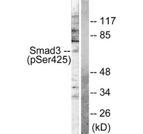 Western Blot - Anti-Smad3 (phospho Ser425) Antibody (A0031) - Antibodies.com