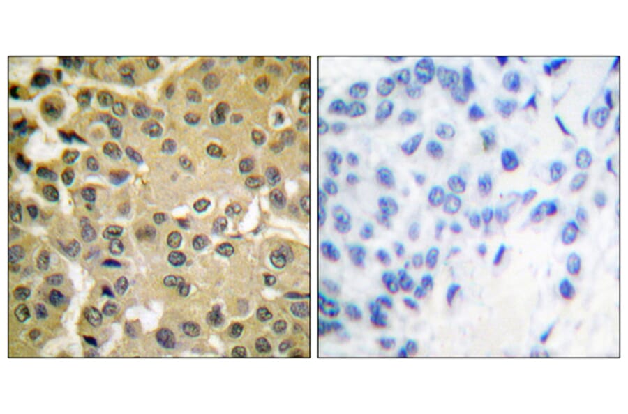 Immunohistochemistry - Anti-Smad3 (phospho Ser425) Antibody (A0031) - Antibodies.com