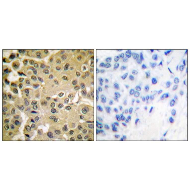 Immunohistochemistry - Anti-Smad3 (phospho Ser425) Antibody (A0031) - Antibodies.com