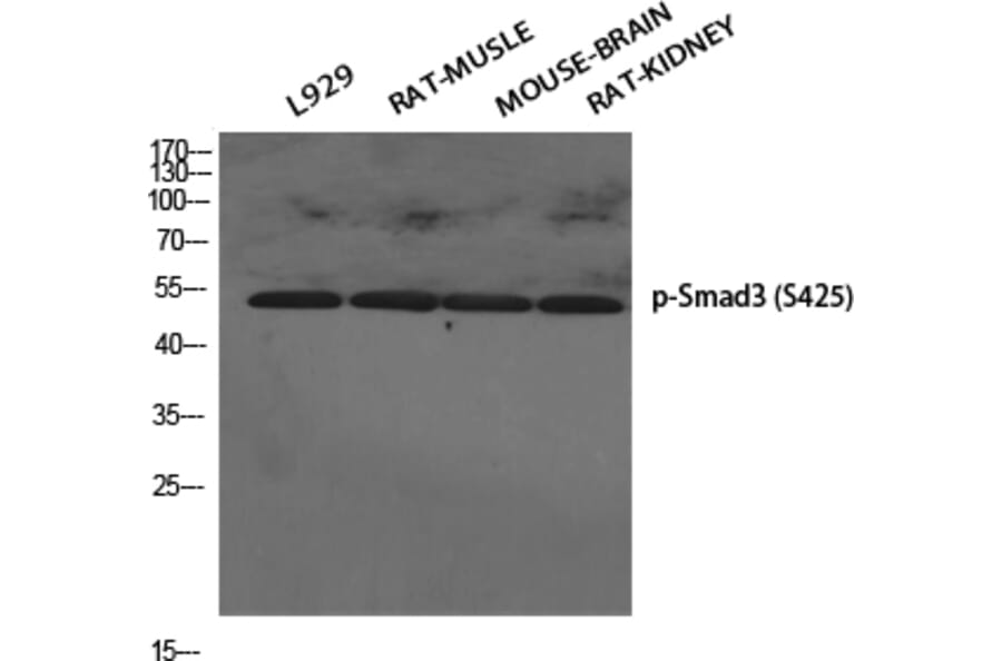 Western Blot - Anti-Smad3 (phospho Ser425) Antibody (A0031) - Antibodies.com