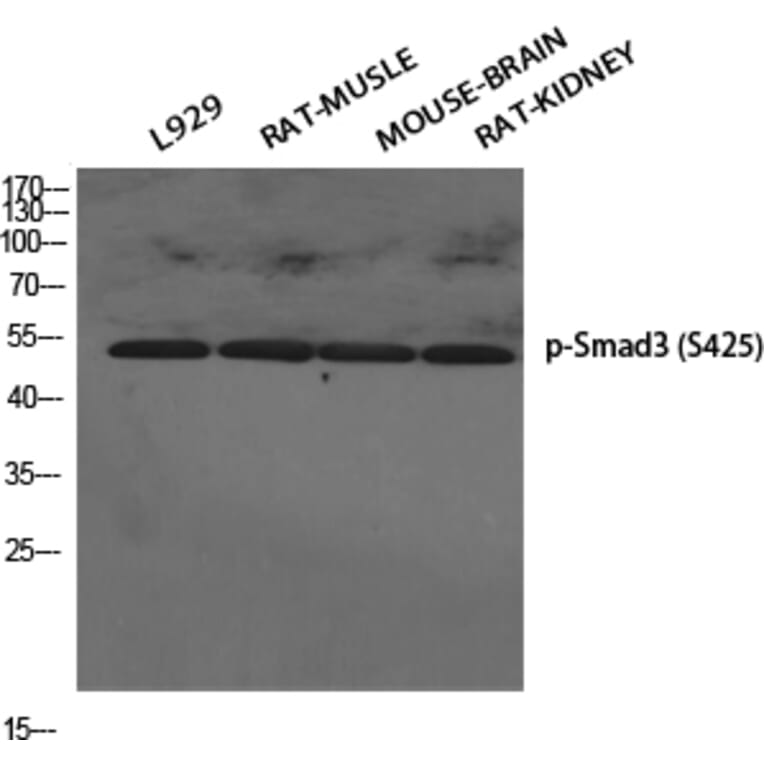 Western Blot - Anti-Smad3 (phospho Ser425) Antibody (A0031) - Antibodies.com