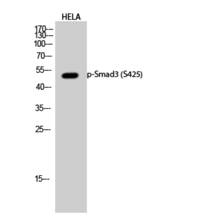 Western Blot - Anti-Smad3 (phospho Ser425) Antibody (A0031) - Antibodies.com