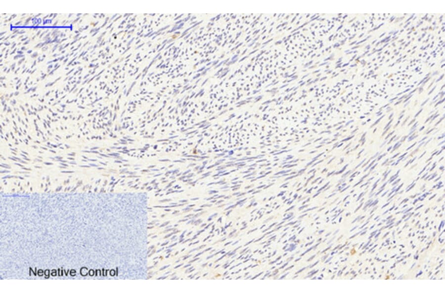 Immunohistochemistry - Anti-Smad3 (phospho Ser425) Antibody (A0031) - Antibodies.com