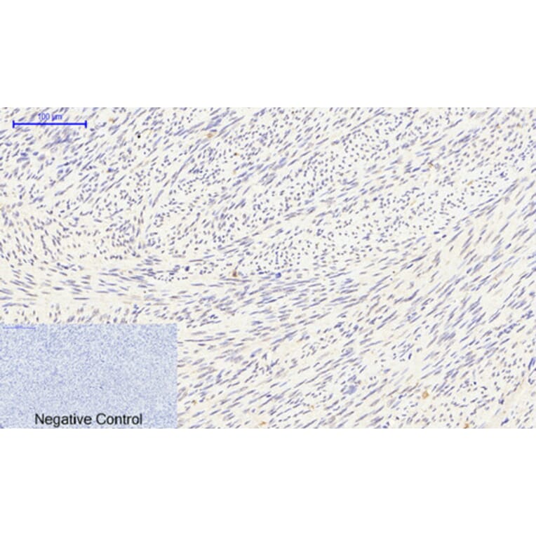 Immunohistochemistry - Anti-Smad3 (phospho Ser425) Antibody (A0031) - Antibodies.com