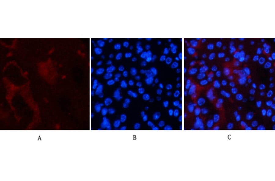 Immunofluorescence - Anti-Smad3 (phospho Ser425) Antibody (A0031) - Antibodies.com