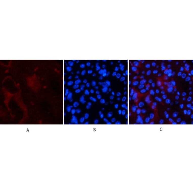 Immunofluorescence - Anti-Smad3 (phospho Ser425) Antibody (A0031) - Antibodies.com