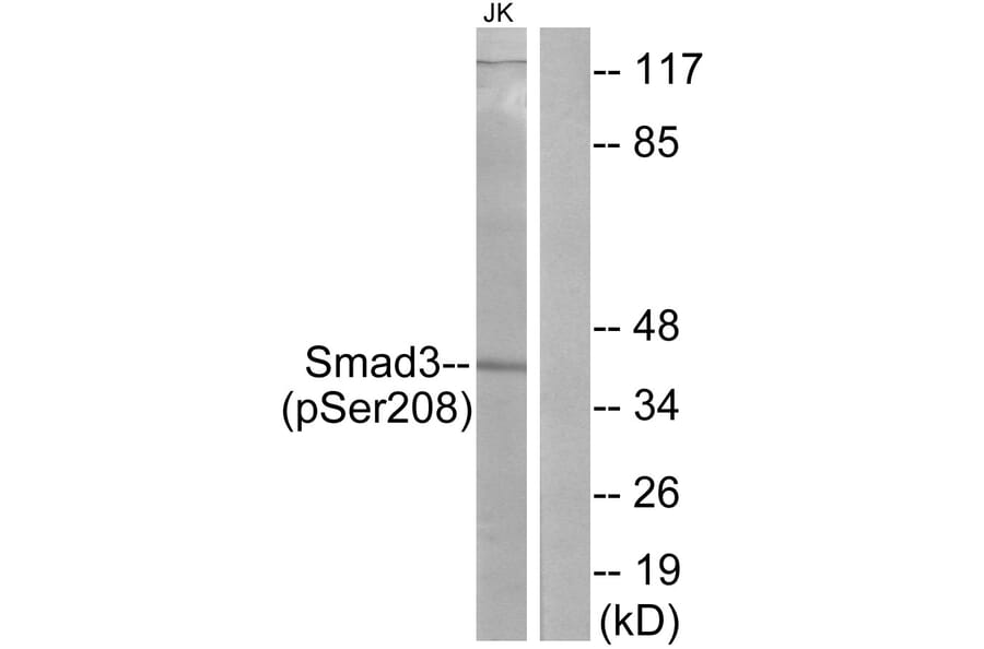 Western Blot - Anti-Smad3 (phospho Ser208) Antibody (A1005) - Antibodies.com