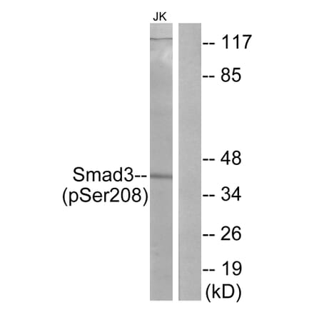 Western Blot - Anti-Smad3 (phospho Ser208) Antibody (A1005) - Antibodies.com