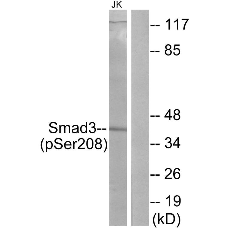 Western Blot - Anti-Smad3 (phospho Ser208) Antibody (A1005) - Antibodies.com