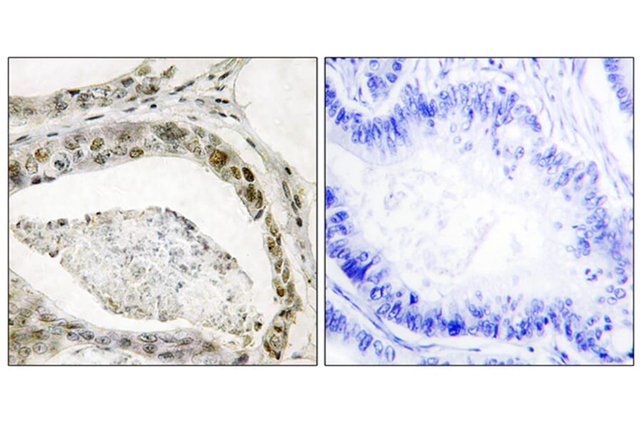 Immunohistochemistry - Anti-Smad3 (phospho Ser208) Antibody (A1005) - Antibodies.com