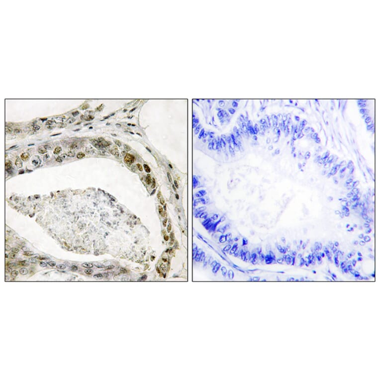 Immunohistochemistry - Anti-Smad3 (phospho Ser208) Antibody (A1005) - Antibodies.com