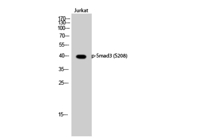 Western Blot - Anti-Smad3 (phospho Ser208) Antibody (A1005) - Antibodies.com