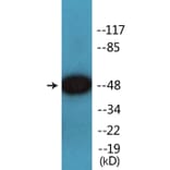 Western Blot - Anti-Smad3 (phospho Ser208) Antibody (P12-1178) - Antibodies.com