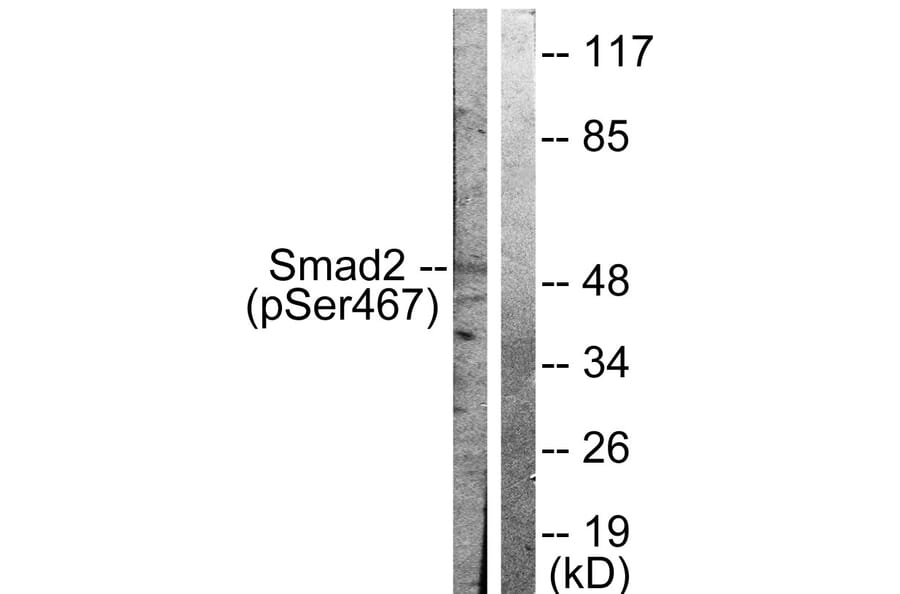 Western Blot - Anti-Smad2 (phospho Ser467) Antibody (A0030) - Antibodies.com