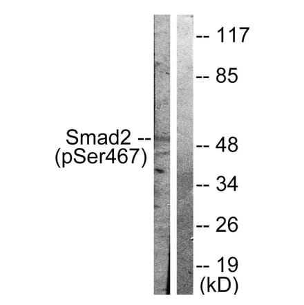 Western Blot - Anti-Smad2 (phospho Ser467) Antibody (A0030) - Antibodies.com