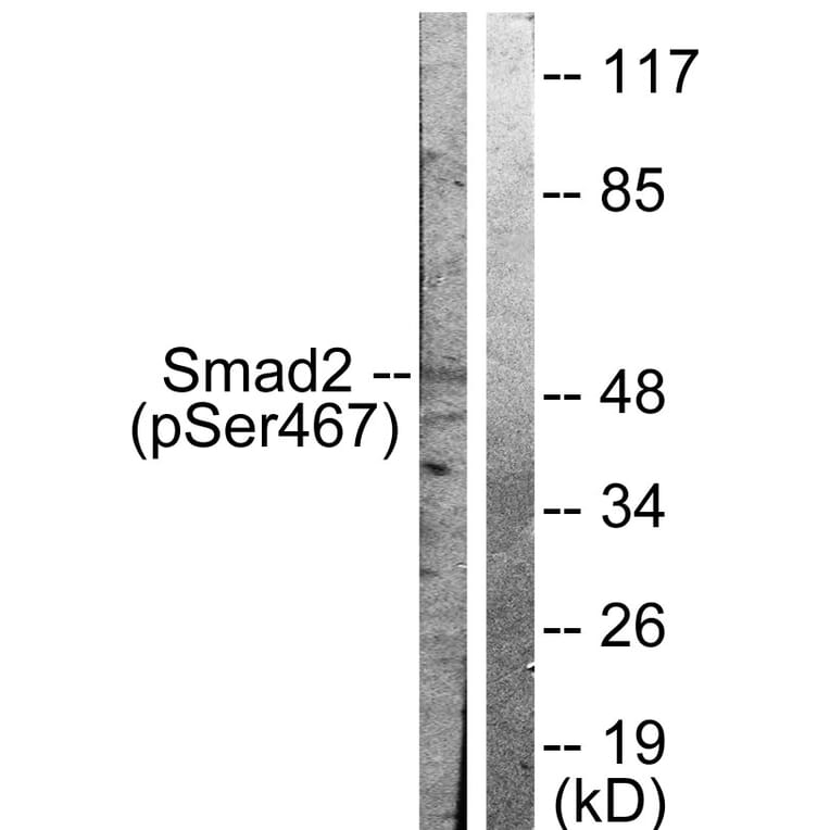 Western Blot - Anti-Smad2 (phospho Ser467) Antibody (A0030) - Antibodies.com