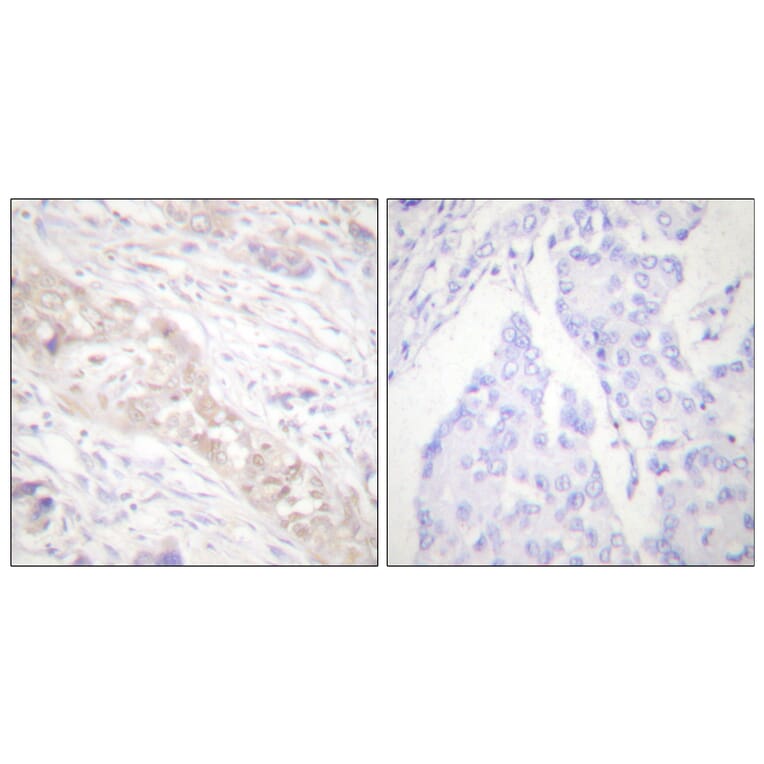 Immunohistochemistry - Anti-Smad2 (phospho Ser467) Antibody (A0030) - Antibodies.com