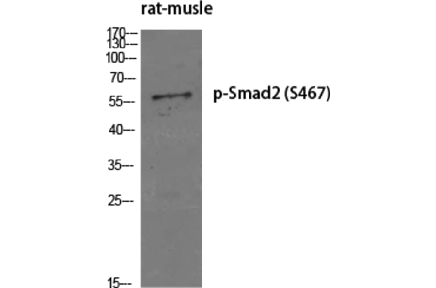Western Blot - Anti-Smad2 (phospho Ser467) Antibody (A0030) - Antibodies.com