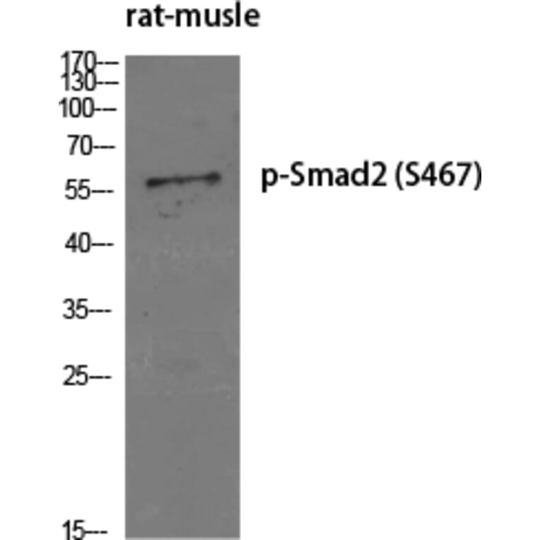 Western Blot - Anti-Smad2 (phospho Ser467) Antibody (A0030) - Antibodies.com