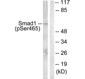 Western Blot - Anti-Smad1 (phospho Ser465) Antibody (A0029) - Antibodies.com