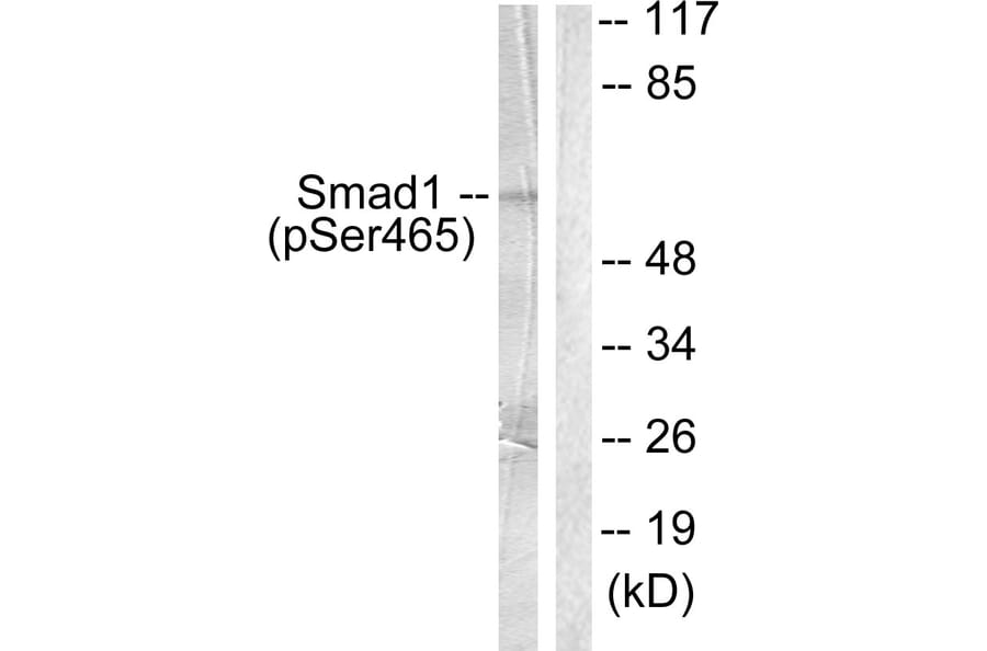 Western Blot - Anti-Smad1 (phospho Ser465) Antibody (A0029) - Antibodies.com