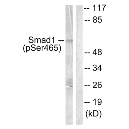 Western Blot - Anti-Smad1 (phospho Ser465) Antibody (A0029) - Antibodies.com