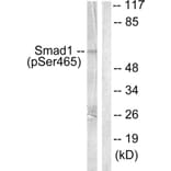 Western Blot - Anti-Smad1 (phospho Ser465) Antibody (A0029) - Antibodies.com