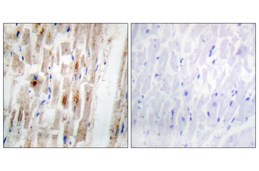 Immunohistochemistry - Anti-Smad1 (phospho Ser465) Antibody (A0029) - Antibodies.com