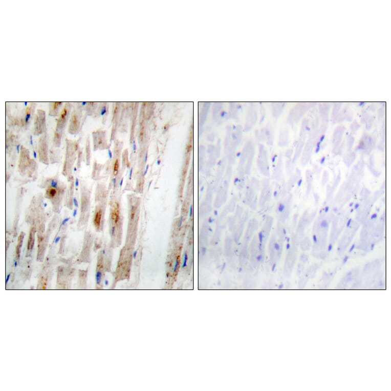 Immunohistochemistry - Anti-Smad1 (phospho Ser465) Antibody (A0029) - Antibodies.com