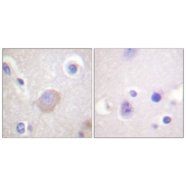 Immunohistochemistry - Anti-SHP-2 (phospho Tyr542) Antibody (A0027) - Antibodies.com