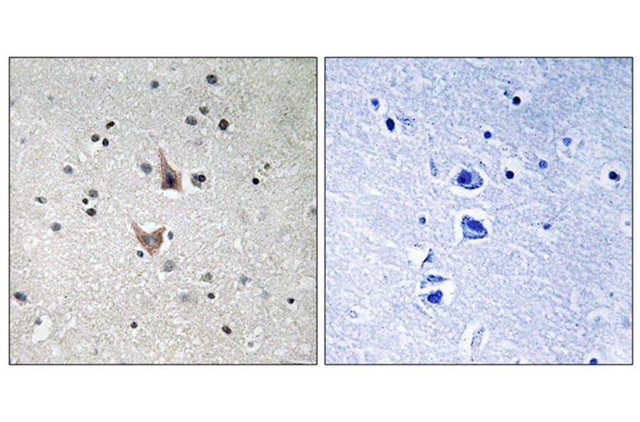 Immunohistochemistry - Anti-PSEN1 (phospho Ser357) Antibody (A8404) - Antibodies.com