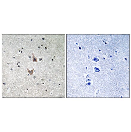 Immunohistochemistry - Anti-PSEN1 (phospho Ser357) Antibody (A8404) - Antibodies.com