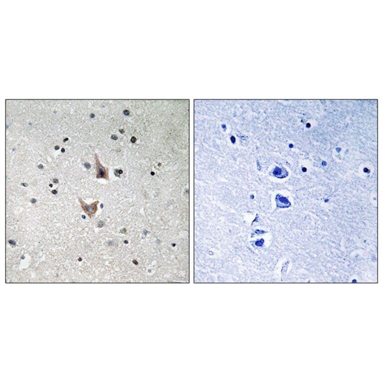 Immunohistochemistry - Anti-PSEN1 (phospho Ser357) Antibody (A8404) - Antibodies.com