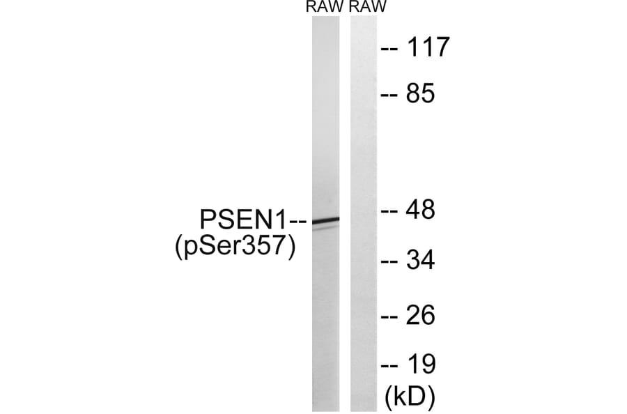 Western Blot - Anti-PSEN1 (phospho Ser357) Antibody (A8404) - Antibodies.com