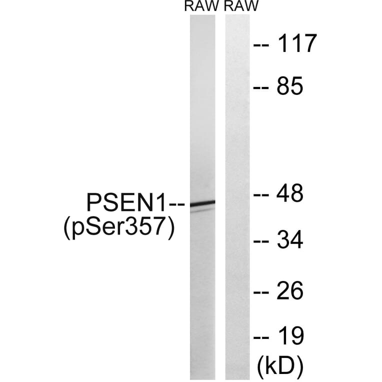 Western Blot - Anti-PSEN1 (phospho Ser357) Antibody (A8404) - Antibodies.com