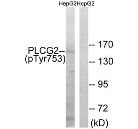 Western Blot - Anti-PLCG2 (phospho Tyr753) Antibody (A0081) - Antibodies.com