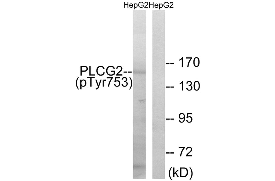 Western Blot - Anti-PLCG2 (phospho Tyr753) Antibody (A0081) - Antibodies.com